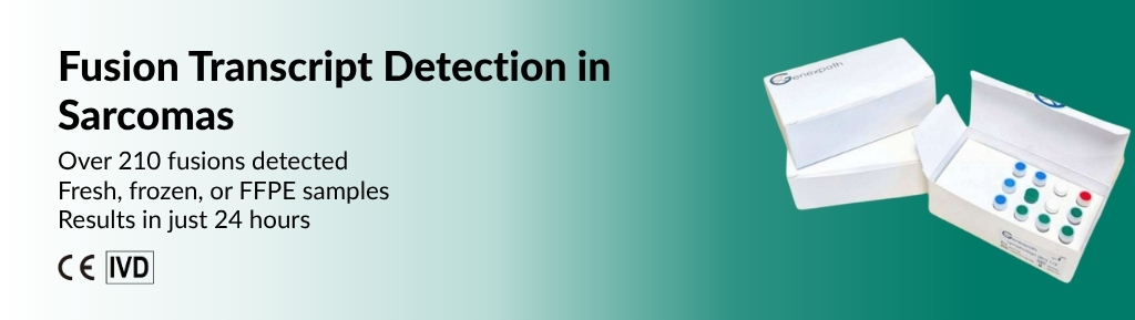 Sarcoma diagnostic in a single reaction