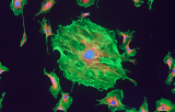 EML4 probe for ISH CE/IVD - Pulmonary pathology