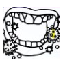 Buccal