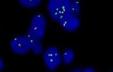 Molecular cytogenetics