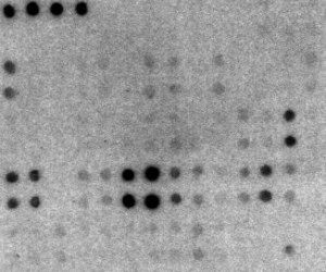 Custom service : Qualitative Cytokine antibody microarray