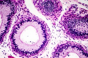 Optimize your IHC results