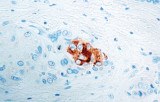 Anti-Alpha Fetoprotein (AFP) CE/IVD for IHC - Genitourinary pathology