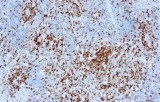 Anti-ALK CE/IVD for IHC - Hematopathology