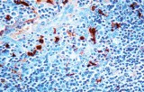 Anti-Antichymotrypsin CE/IVD for IHC - Hematopathology