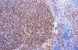 Anti-Antitrypsin CE/IVD for IHC - Hematopathology