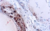 Anti-Calcitonin CE/IVD for IHC - Cytopathology