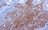 Anti-Calretinin CE/IVD for IHC - Cytopathology