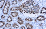 Anti-CD10 CE/IVD for IHC - Hematopathology