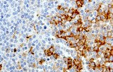 Anti-CD138 CE/IVD for IHC - Hematopathology