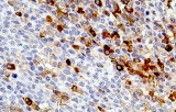 Anti-CD14 CE/IVD for IHC - Hematopathology