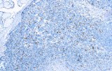 Anti-CD163 CE/IVD for IHC - Hematopathology