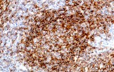 Anti-CD19 CE/IVD for IHC - Hematopathology