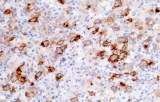 Anti-CD25 CE/IVD for IHC - Hematopathology