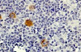 Anti-CD30 CE/IVD for IHC - Hematopathology