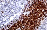 Anti-CD5 CE/IVD for IHC - Hematopathology