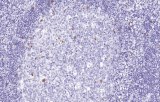 Anti-CD57 CE/IVD for IHC - Hematopathology