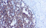 Anti-CD99 CE/IVD for IHC - Soft Tissue pathology