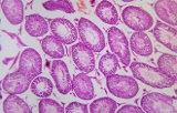 Chromogens for IHC