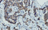 Anti-Chromogranin A CE/IVD for IHC - Pediatric pathology