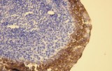 Anti-Cytokeratin 5 & 6 CE/IVD for IHC - Genitourinary pathology