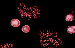 Molecular cytogenetics