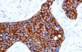 Anti-Cytokeratin 17 CE/IVD for IHC - Gynecological pathology