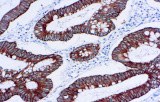 Anti-Cytokeratin 18 CE/IVD for IHC - Gynecological pathology