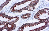Anti-Cytokeratin 18 CE/IVD for IHC - Gastrointestinal pathology