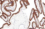 Anti-EGFR CE/IVD for IHC - Hematopathology