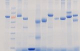 Protein Electrophoresis