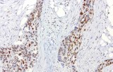 ERCC1