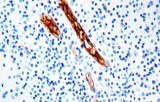 Anti-Factor VIII CE/IVD for IHC - Hematopathology