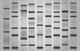 Western Blot consumables