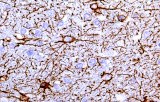 Anti-GFAP CE/IVD for IHC - Neuropathology