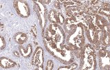 Anti-GLUT1 CE/IVD for IHC - Pulmonary pathology