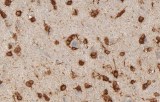 Anti-IDH1 R132H CE/IVD for IHC - Neuropathology