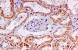 Immunohistochemistry (IHC) products