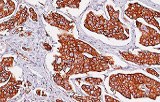 Detection kits for IHC