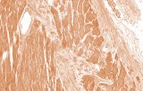 Extemporaneous IHC
