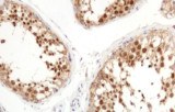 Anti-Inhibin alpha CE/IVD for IHC - Genitourinary pathology