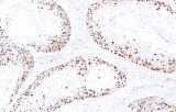 Anti-Ki-67 CE/IVD for IHC - Genitourinary pathology