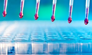 Protease assay kits