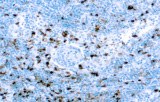 Anti-Myeloperoxidase CE/IVD for IHC - Hematopathology