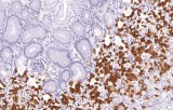 Anti-MUC6 CE/IVD for IHC - Gastrointestinal pathology