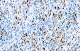 Anti-MyoD1 CE/IVD for IHC - Pediatric pathology