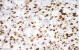 Anti-Myogenin CE/IVD for IHC - Pediatric pathology