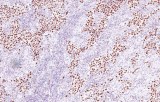 Anti-Nanog CE/IVD for IHC - Genitourinary pathology