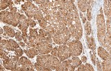 Anti-Nestin CE/IVD for IHC - Dermopathology