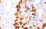 Anti-NGFR CE/IVD for IHC - Dermopathology